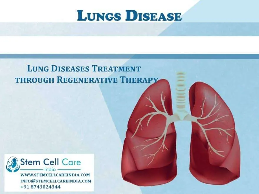 Stem Cells for Lung Disease