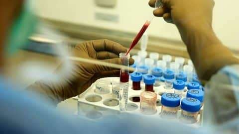 Stem Cell Treatment