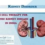 Stem Cell Therapy Kidney Disease