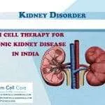 Stem Cell Therapy Kidney Disease
