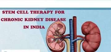 Stem Cell Therapy Kidney Disease