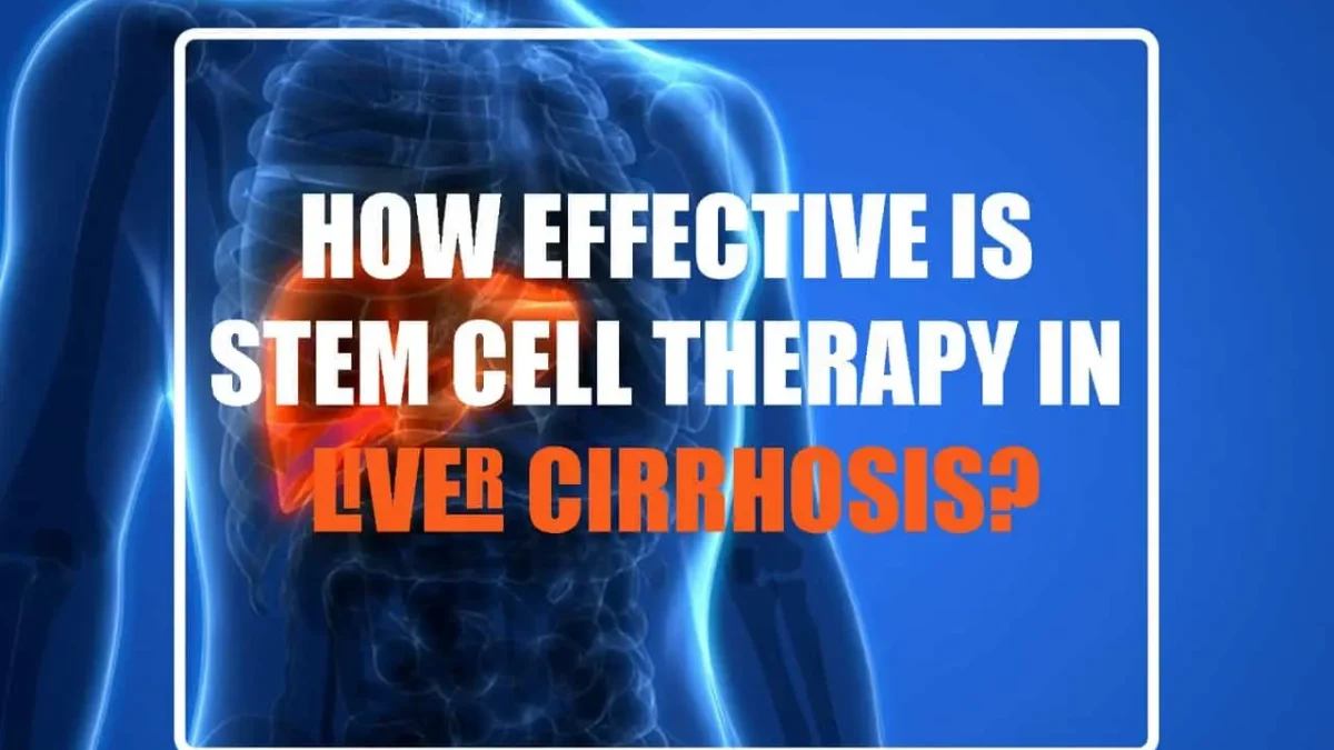 How Effective is Stem Cell Therapy in Liver Cirrhosis?
