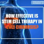 How Effective is Stem Cell Therapy in Liver Cirrhosis?