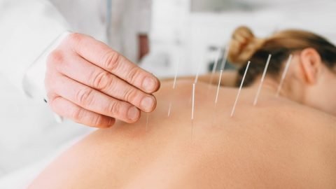 Acupuncture Therapy in India