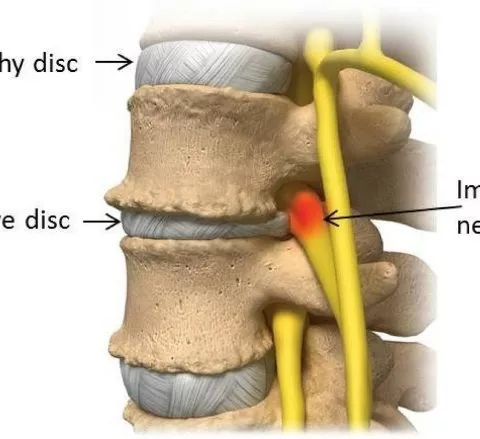Osteoarthritis Stem Cell Treatment Or Therapy In Delhi India Home osteoarthritis-stem-cell-treatment-or-therapy-in-delhi-india-home