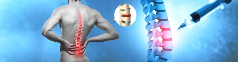 Stem Cell Treatment for Degenerative Disc in India