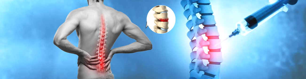 Stem Cell Treatment for Degenerative Disc in India