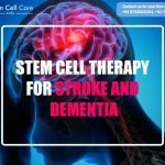 Stem Cell Therapy