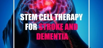 Stem Cell Therapy