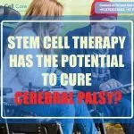 Stem Cell Therapy Cerebral Palsy