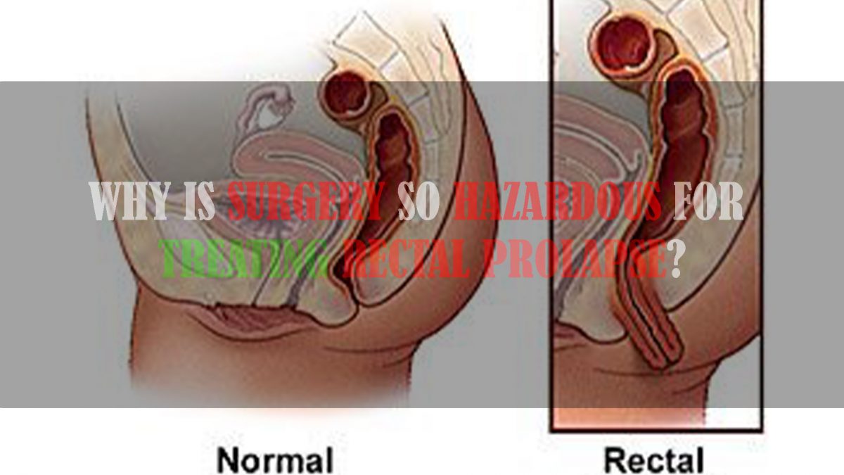 Why is Surgery So Hazardous for Treating Rectal Prolapse