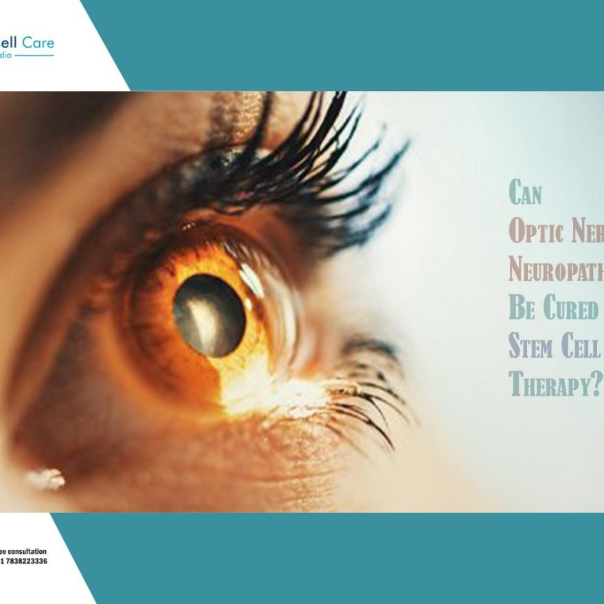 What Is Optic Nerve Regeneration in 2025?