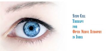 Optic Nerve Atrophy