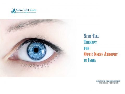 Optic Nerve Atrophy
