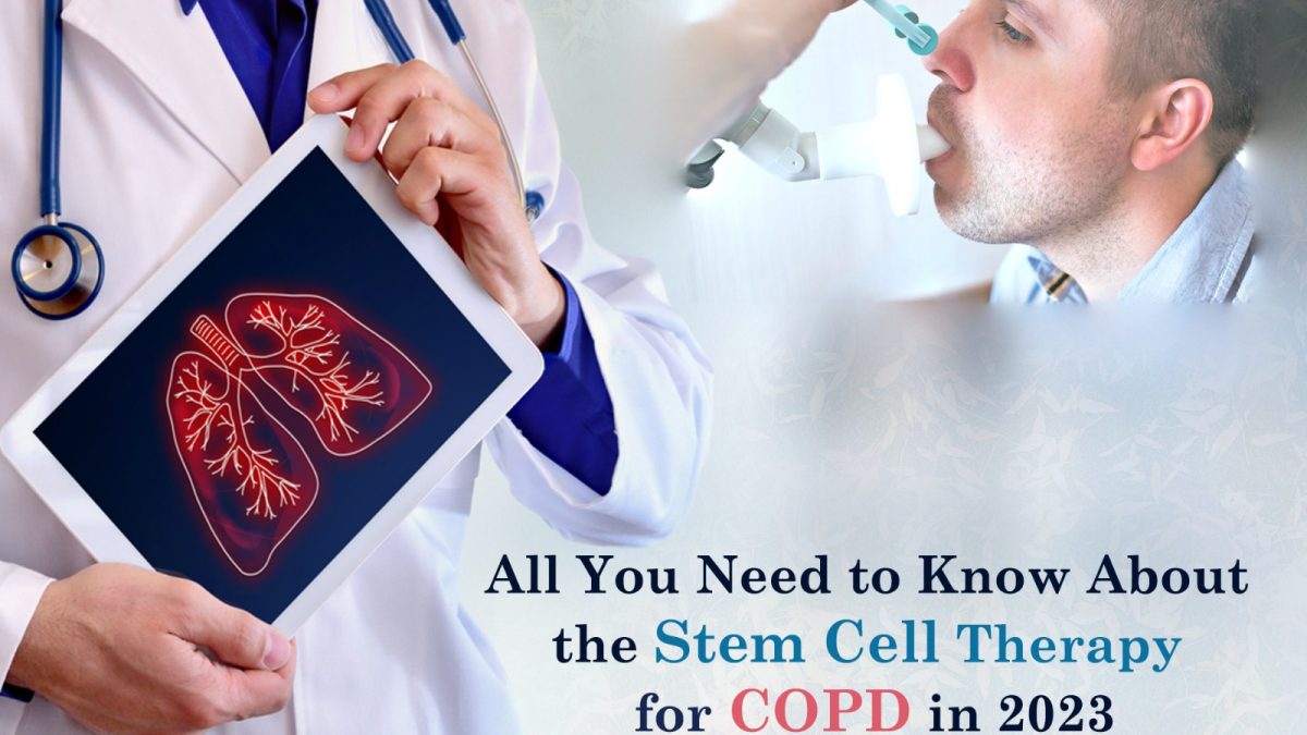 All You Need to Know About the Stem Cell Therapy for COPD in 2023