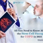 All You Need to Know About the Stem Cell Therapy for COPD in 2023