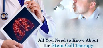 All You Need to Know About the Stem Cell Therapy for COPD in 2023