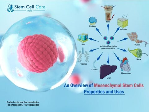 Mesenchymal Stem Cells