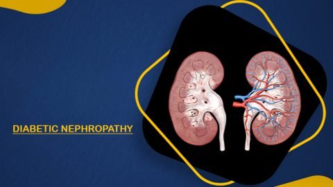 Diabetic-Nephropathy