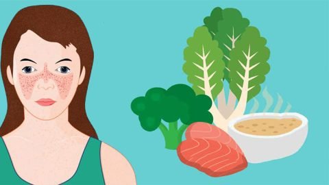 Diet-tips-for-Systemic-Lupus