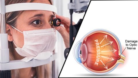 Glaucoma