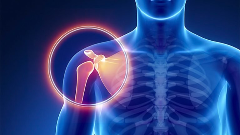 Diet Tips Plan for Shoulder Injuries Patients - Stem Cell Care India