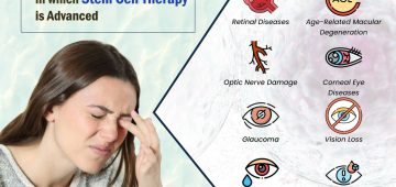 List of Eye Conditions in which Stem Cell Therapy is Advanced