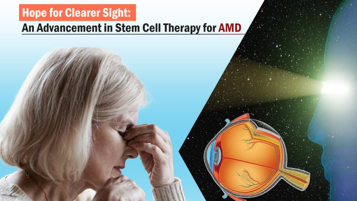 Age-related macular degeneration