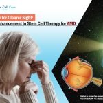 Age-related macular degeneration