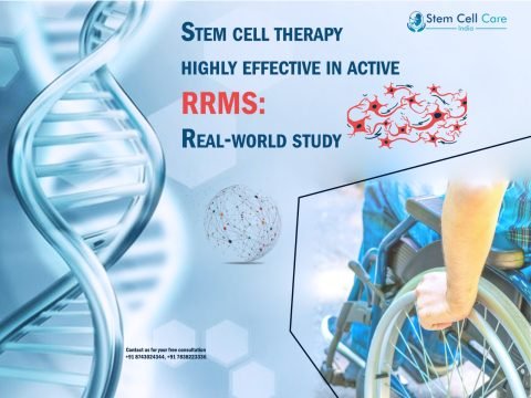 Stem cell therapy in Multiple Sclerosis