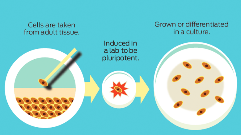 How-Stem-Cell-Therapy