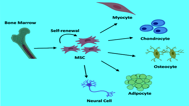 Mesenchymal Stem Cell Therapy