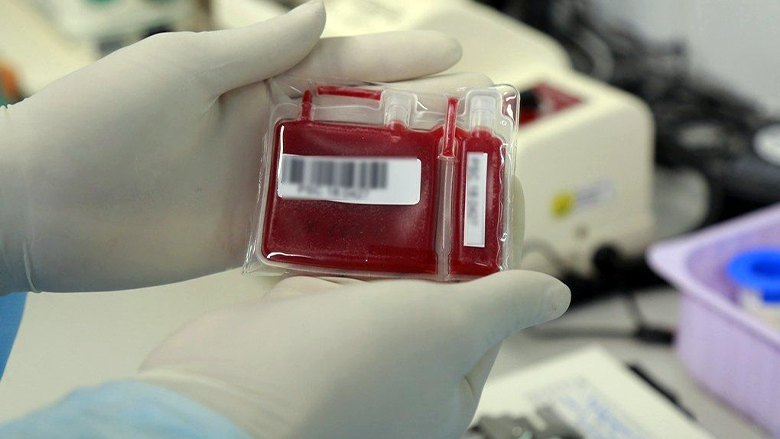 Stem Cell Collection