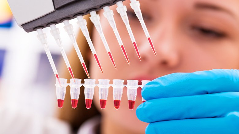 Stem Cell Treatment Procedure