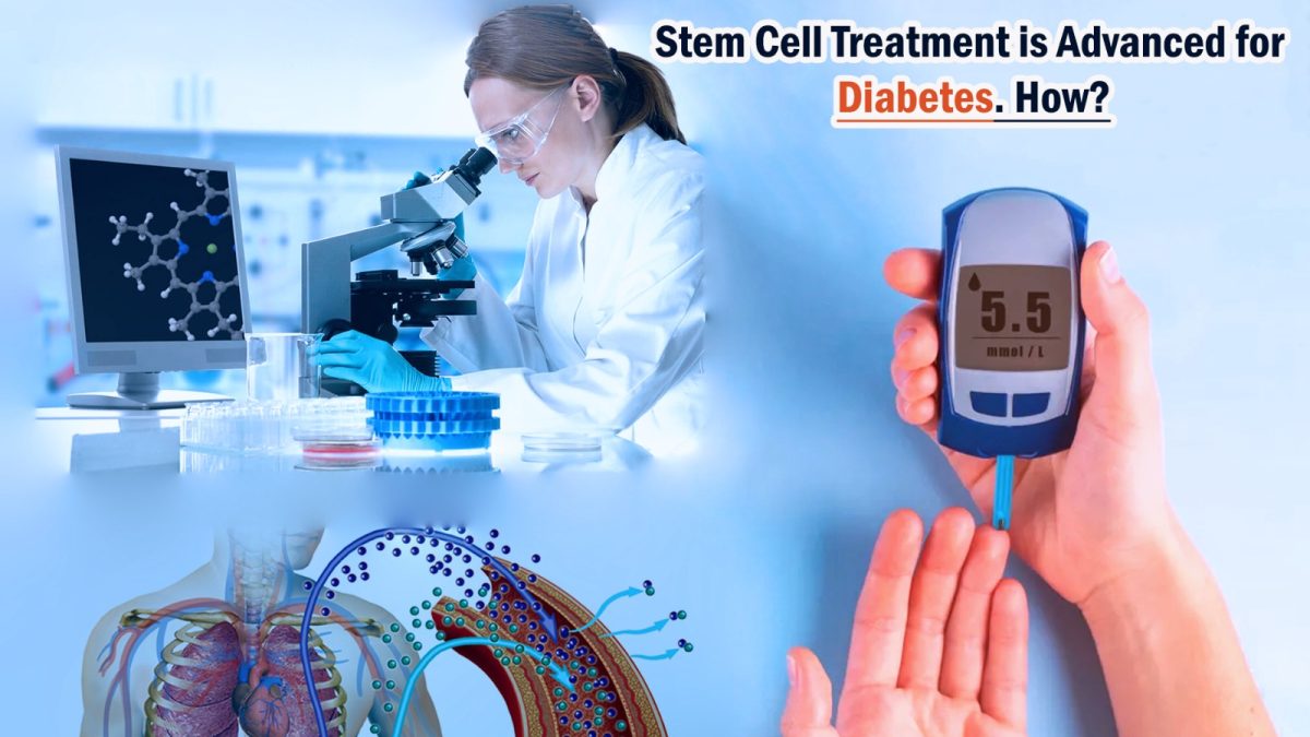 Stem Cell Treatment is Advanced for Diabetes. How?