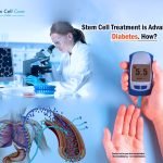 Stem Cell Treatment is Advanced for Diabetes. How?