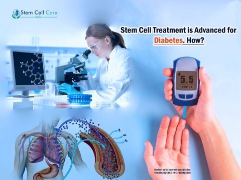 Stem Cell Treatment is Advanced for Diabetes. How?