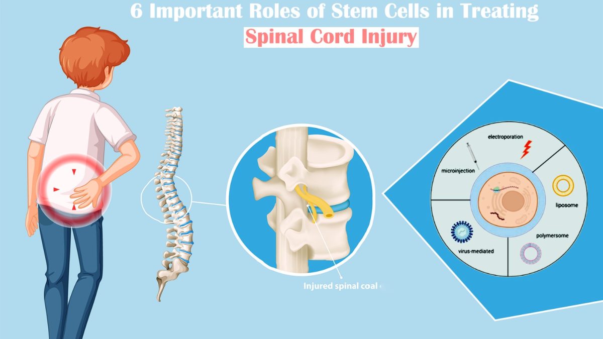 6 Important Roles of Stem Cells in Treating Spinal Cord Injury
