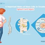 6 Important Roles of Stem Cells in Treating Spinal Cord Injury