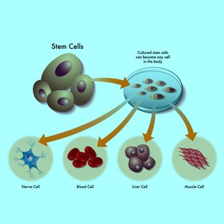 Allogenic Stem Cells in India- Stem Cell Care India
