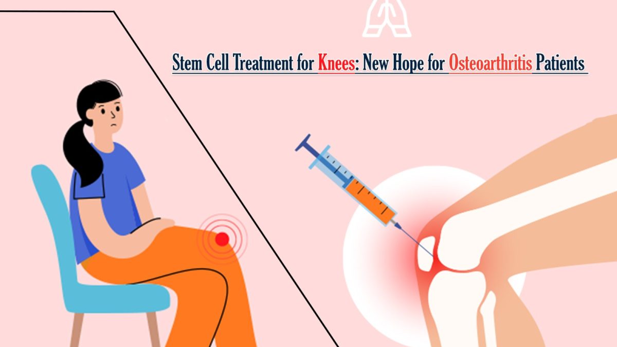 Stem Cell Treatment for Knees: New Hope for Osteoarthritis Patients