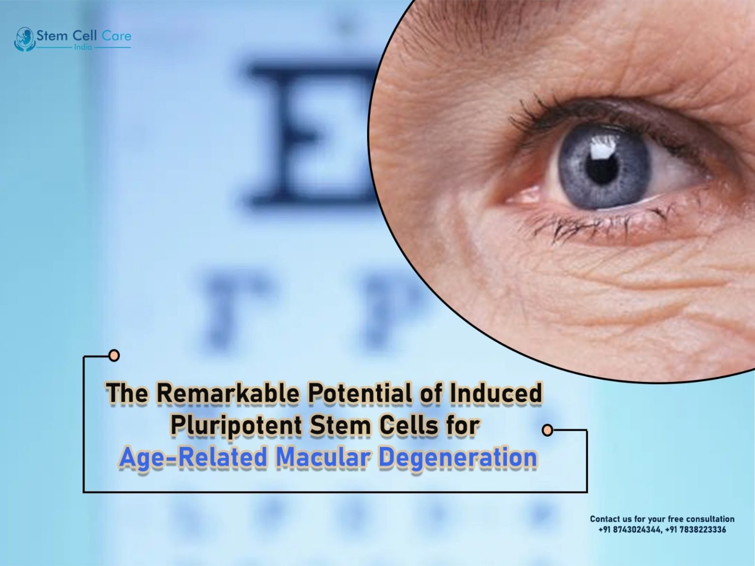 The Remarkable Potential of Induced Pluripotent Stem Cells for Age