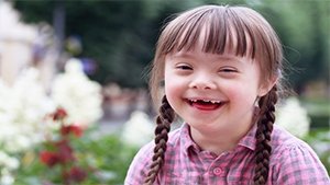 Down Syndrome