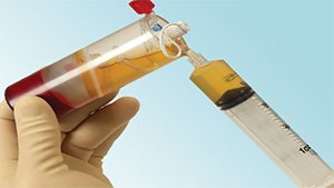Platelet Rich Plasma