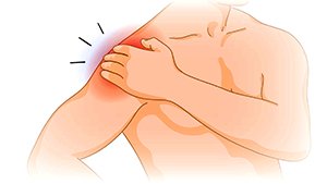 Shoulder Injuries