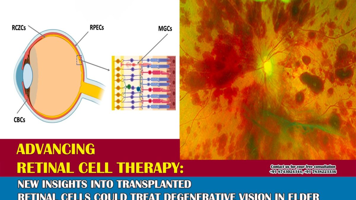 Advancing retinal cell therapy: New insights into transplanted retinal cells could treat degenerative vision in elderly