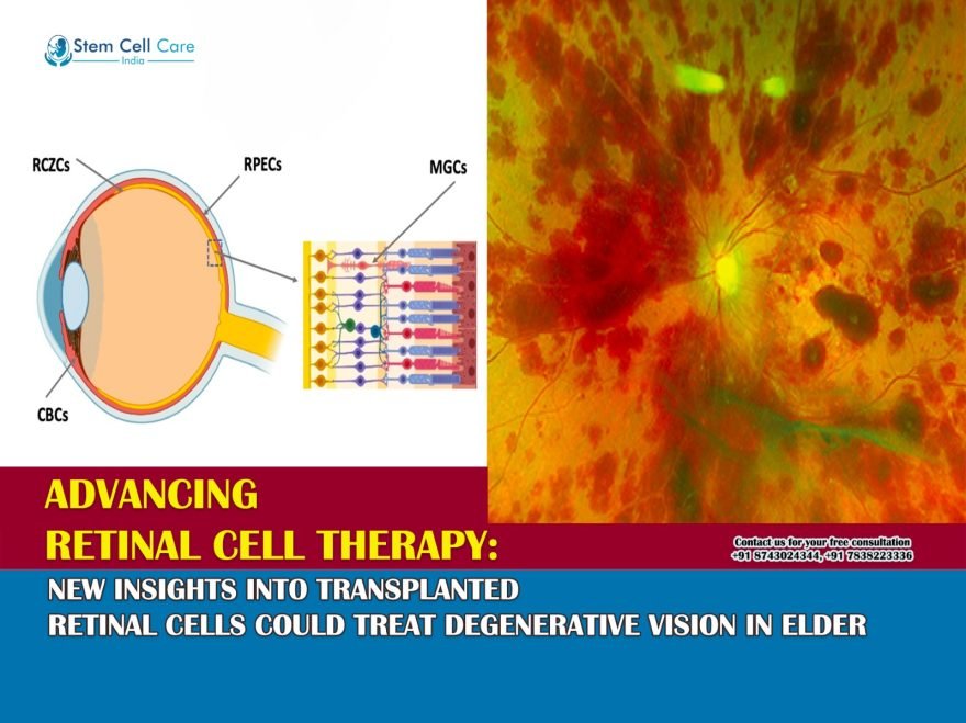 Advancing retinal cell therapy: New insights into transplanted retinal cells could treat degenerative vision in elderly