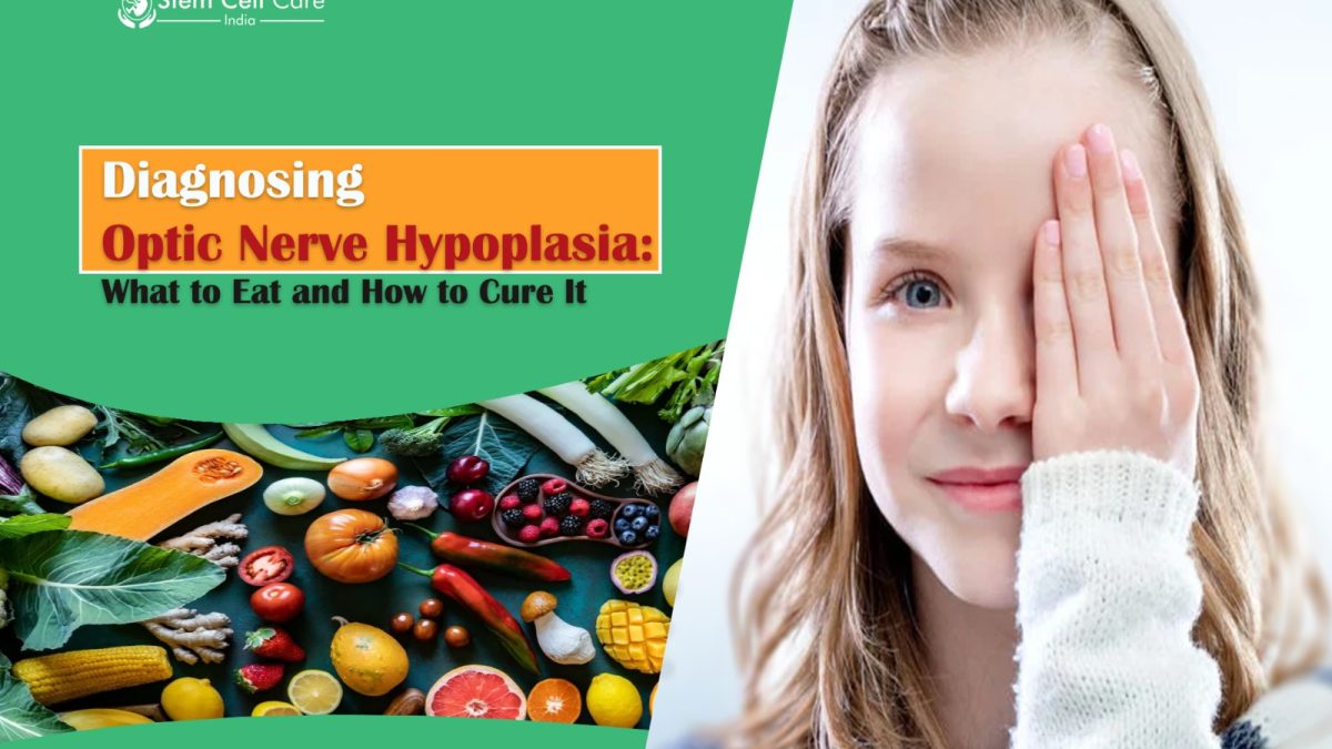Diagnosing Optic Nerve Hypoplasia: What to Eat and How to Cure It
