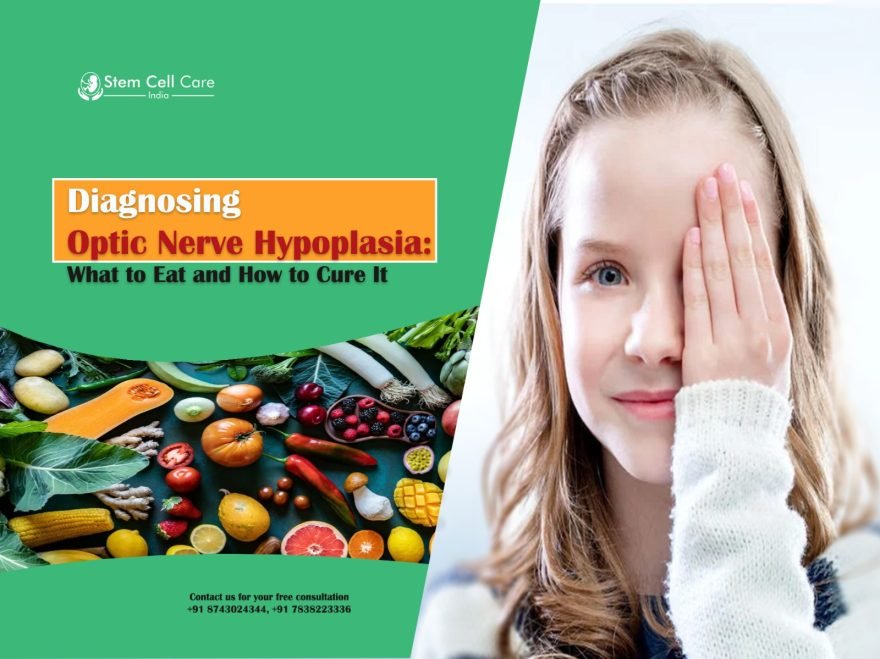Diagnosing Optic Nerve Hypoplasia: What to Eat and How to Cure It