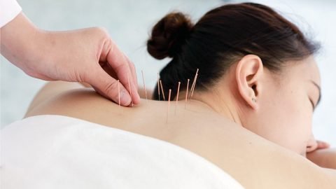 Acupuncture Therapy